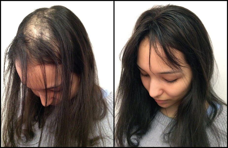 Before and After Wigs and Toppers Jessica Hyllarée Before and After Wigs and Toppers Jessica Hyllarée