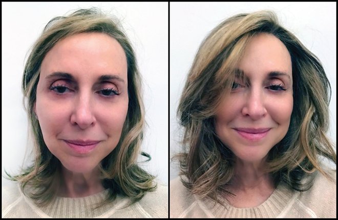 Hair Extension Stylist for Alopecia